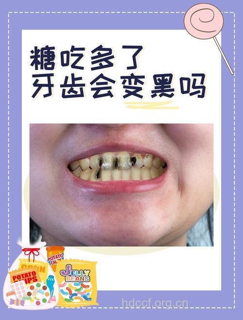饼干对牙齿危害比糖大