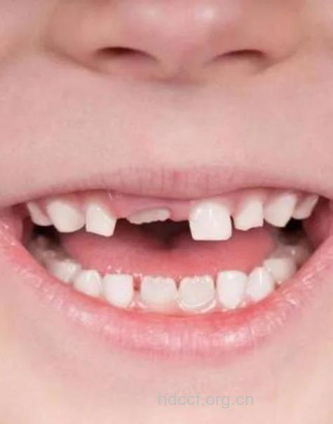 多嚼硬物宝宝牙齿更美观
