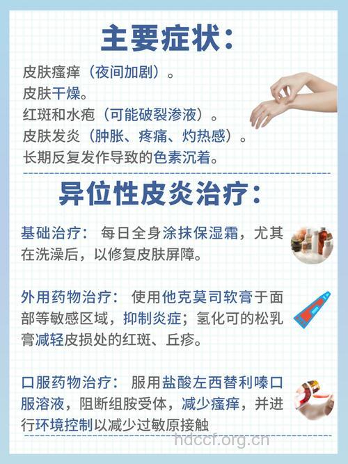 异位性皮炎的相关知识
