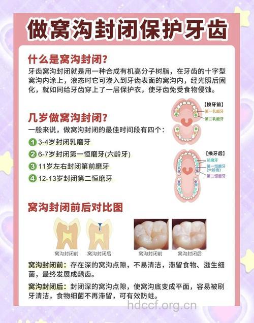 孩子做窝沟封闭有什么好处