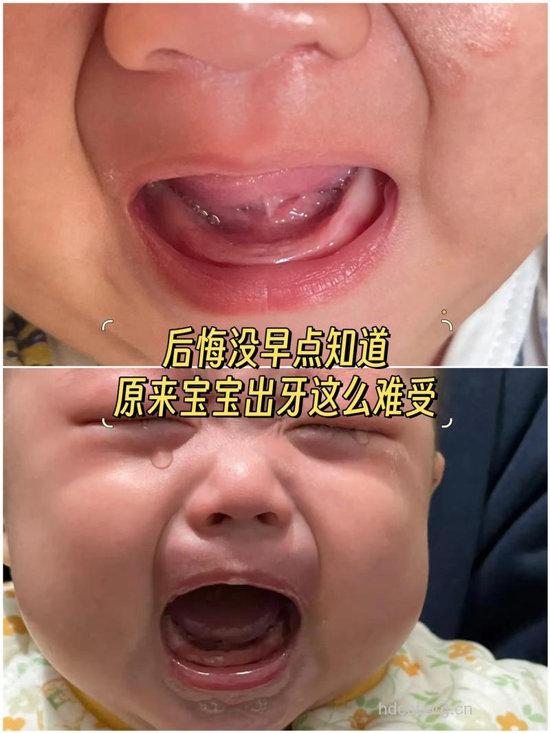 宝宝长牙发脾气怎么办