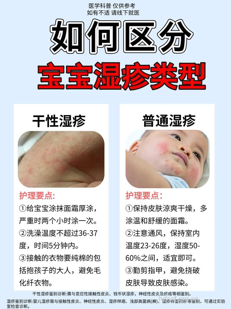 如何判断婴儿患上湿疹