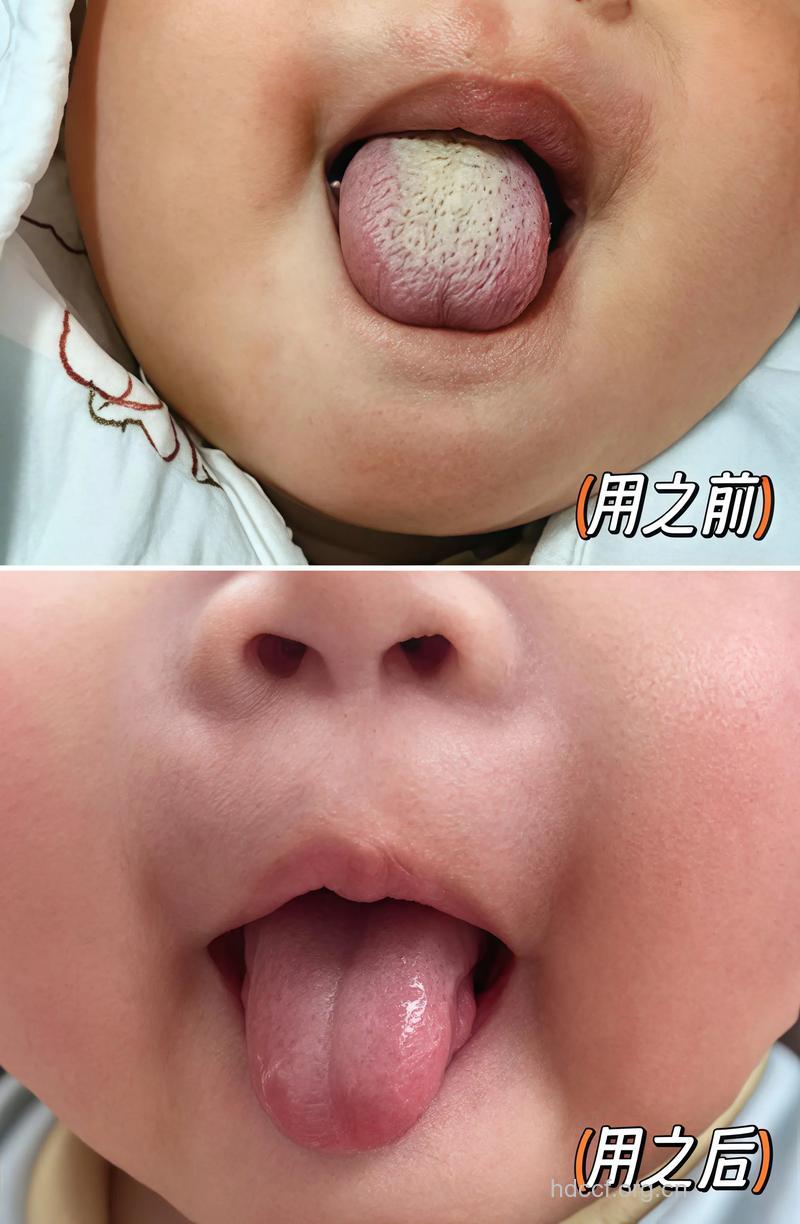 宝宝舌苔发白是怎么原因