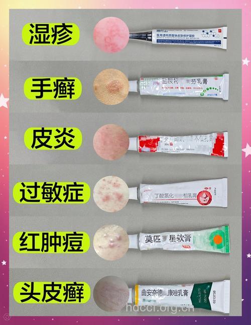 用护肤品可以“治”湿疹?