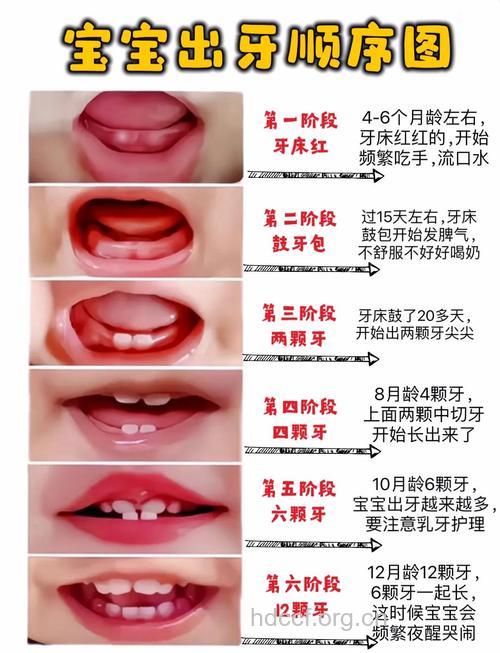 宝宝出牙期有哪些常见口腔问题