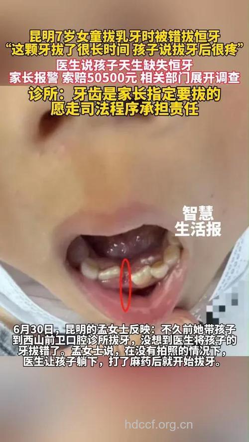 盲目给儿童拔乳牙隐患多