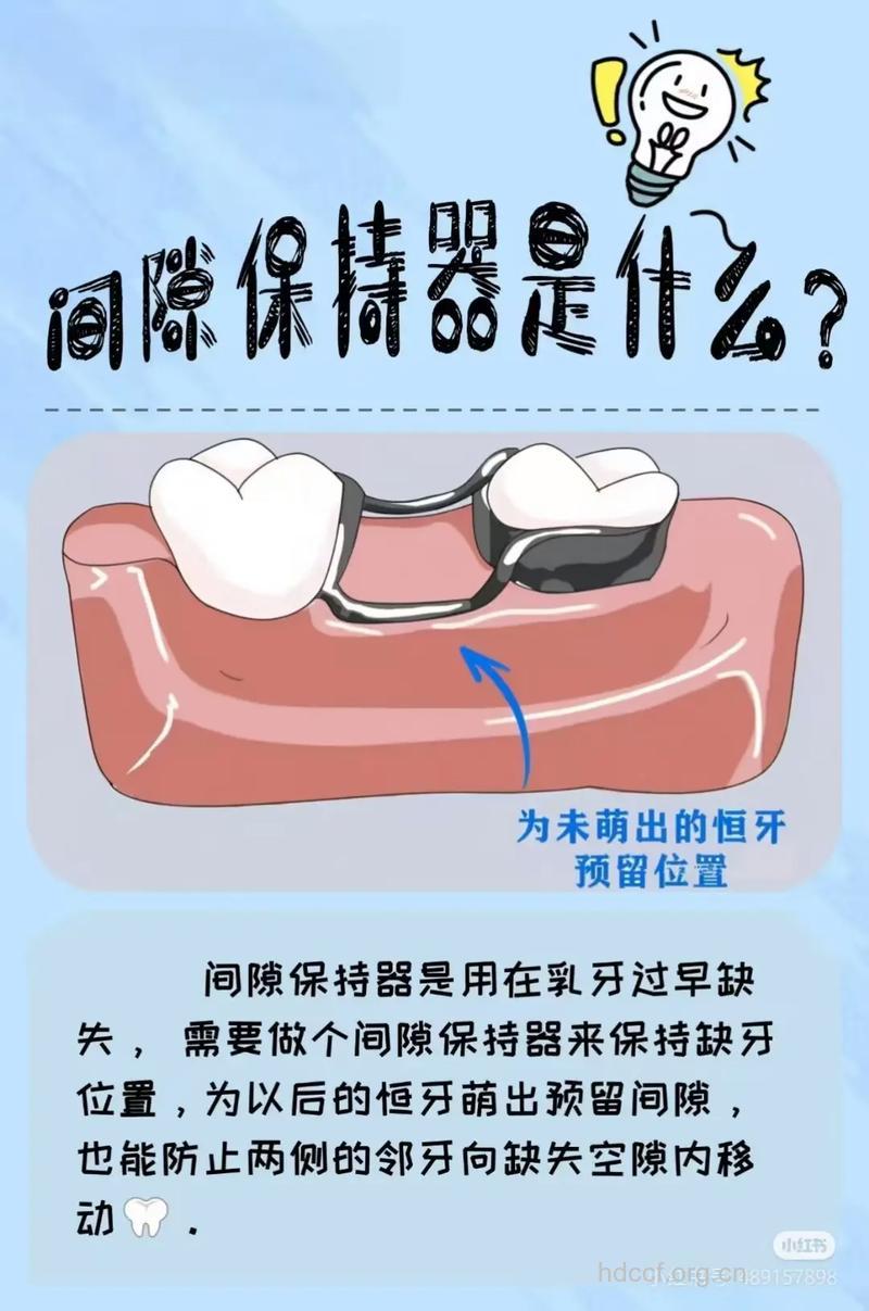 乳牙缺失后应注间隙保持