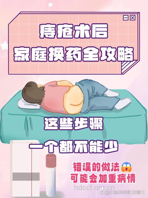 痔疮术后该怎么换药