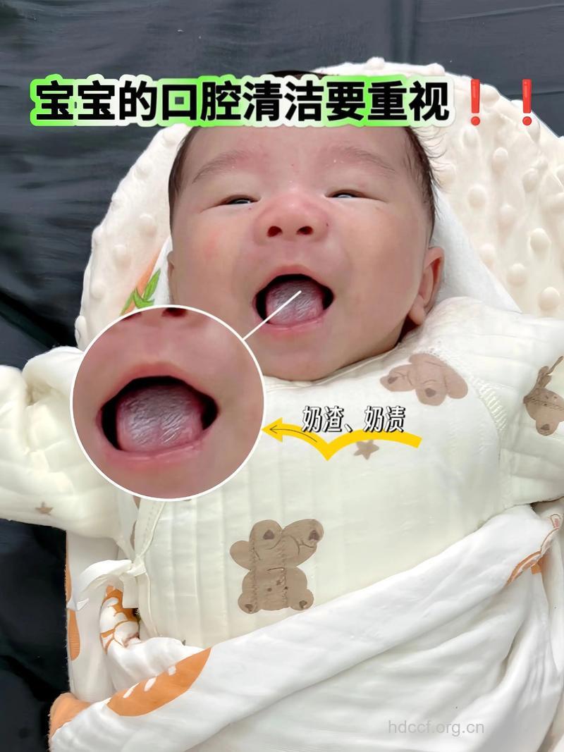 幼儿如何进行口腔护理
