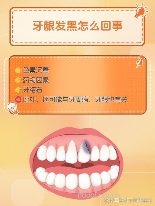 哪些原因导致牙齿变黑