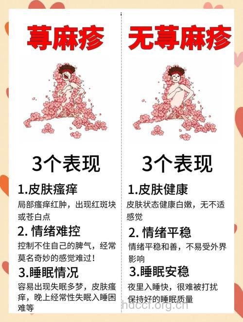了解慢性荨麻疹患者的日常护理