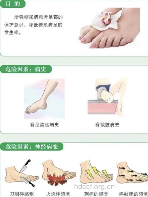 护理糖尿病足的方法