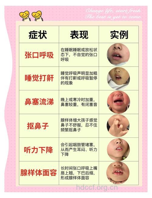 小孩打呼噜可能是生病了