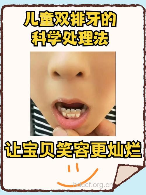 宝宝牙齿不齐是怎么回事