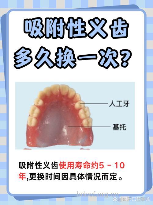 假牙也有寿命 5年更换一次