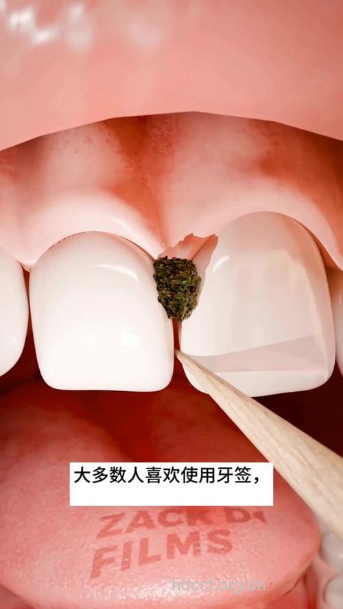 牙签使用不当导致的四大危害