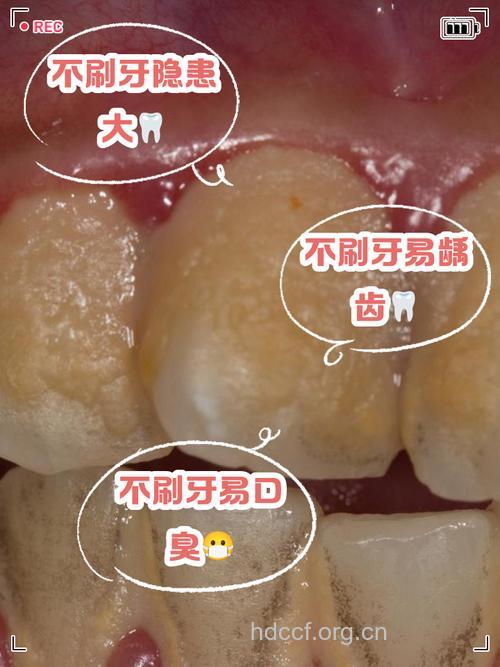 刷牙前不沾水容易损害牙龈