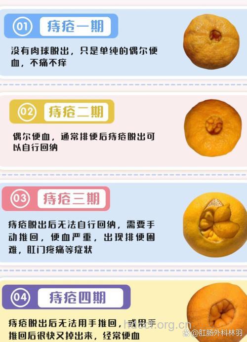 发生痔疮导致的症状是哪些
