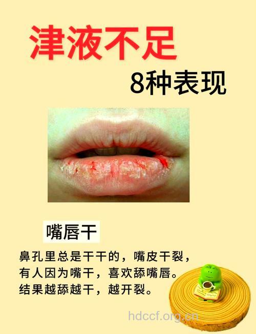 女性口干舌燥 切勿掉以轻心