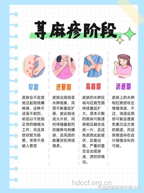 过度紧张可能会引起荨麻疹