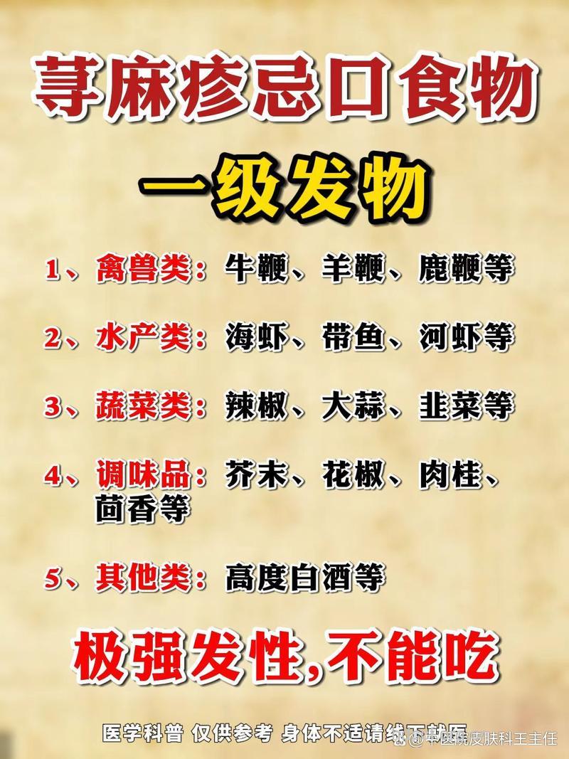 刺激性食物会引发慢性荨麻疹吗