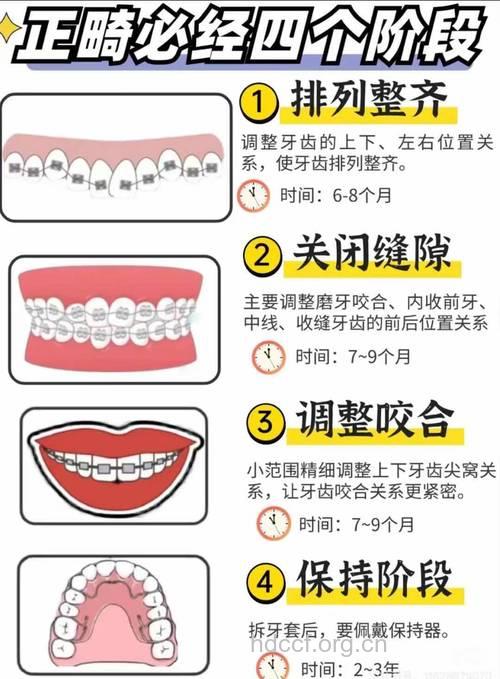 四种美齿的方法
