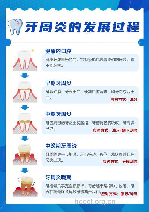 牙周病是怎么形成的