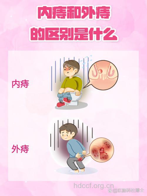 内痔与哪些疾病相似