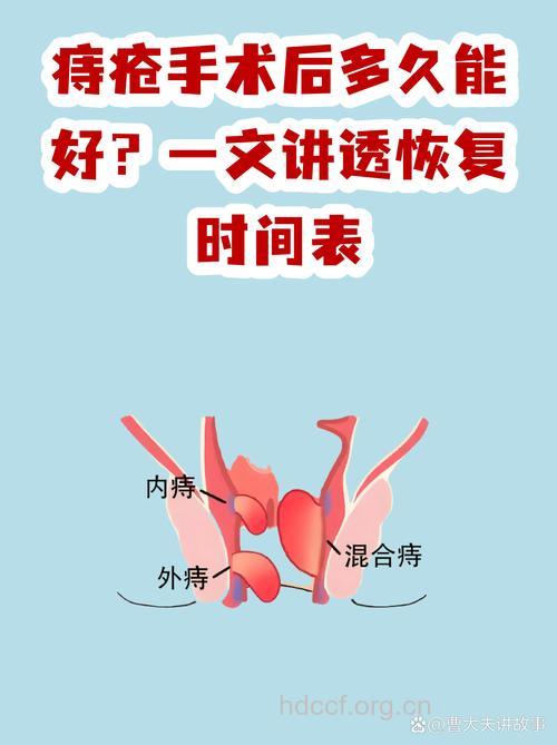 外痔手术的最佳时机是何时