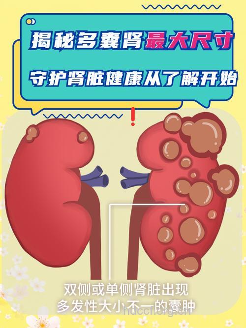 怎么定义多囊肾？