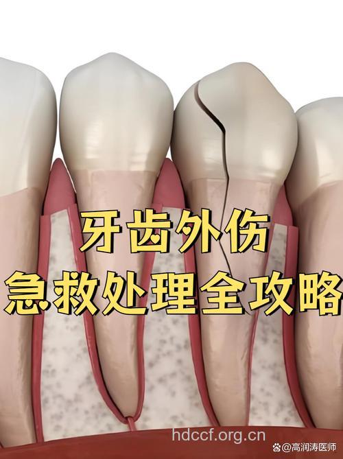 牙医的牙齿为什么也会受伤