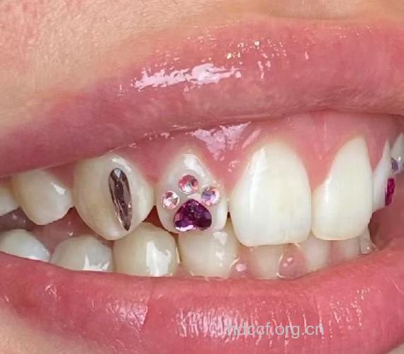 镶牙钻易感染