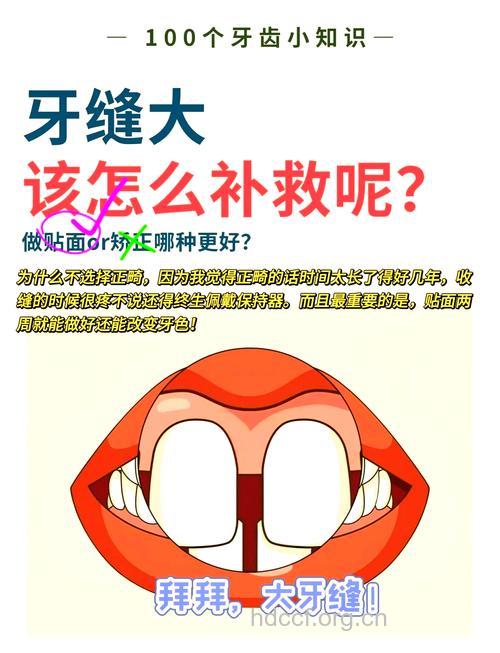 打造完美微笑的独家“绝招”－修补牙龈