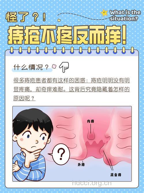 患有内痔疮为何不会感觉痛