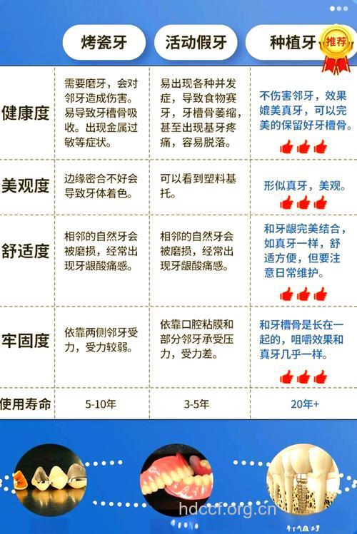 活动假牙的优点和缺点