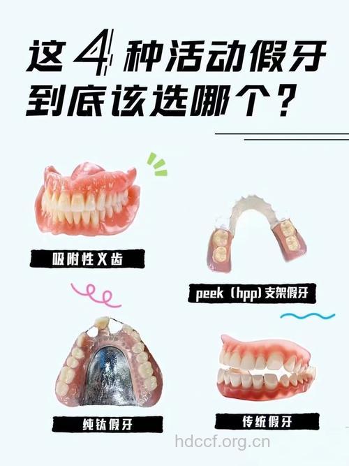 关于活动假牙的一些常识