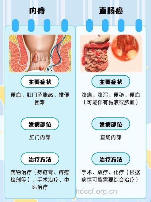 怎么辨别内痔与直肠癌