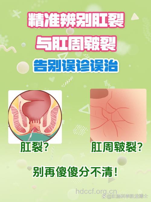 肛裂容易与什么疾病混淆