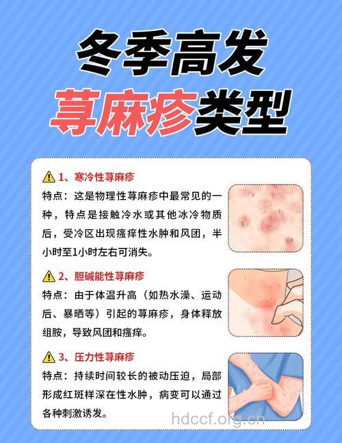 寒冷性荨麻疹过敏治疗过程