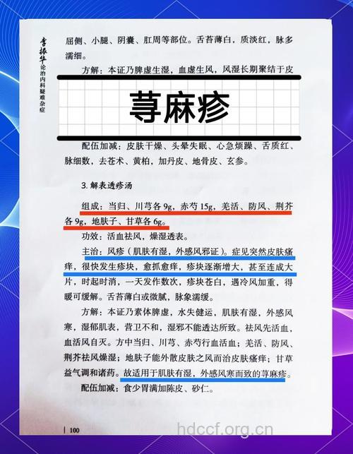 经验方治疗荨麻疹