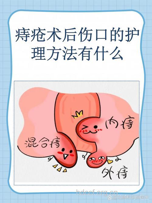 环状混合痔的术后怎么处理