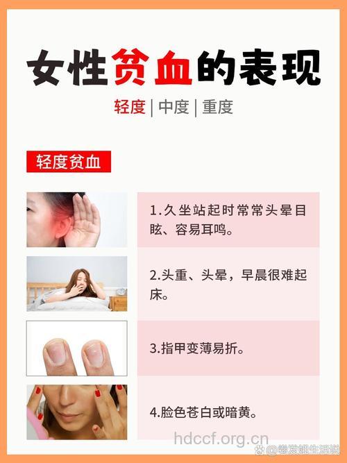 女人有哪些贫血症状