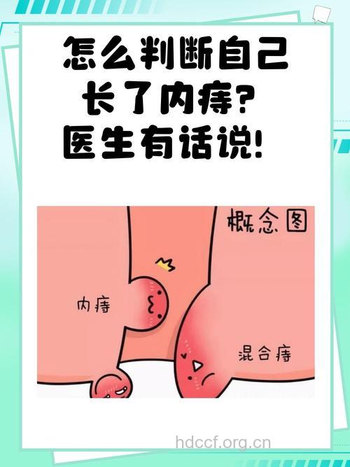 肛门有个东西是内痔吗