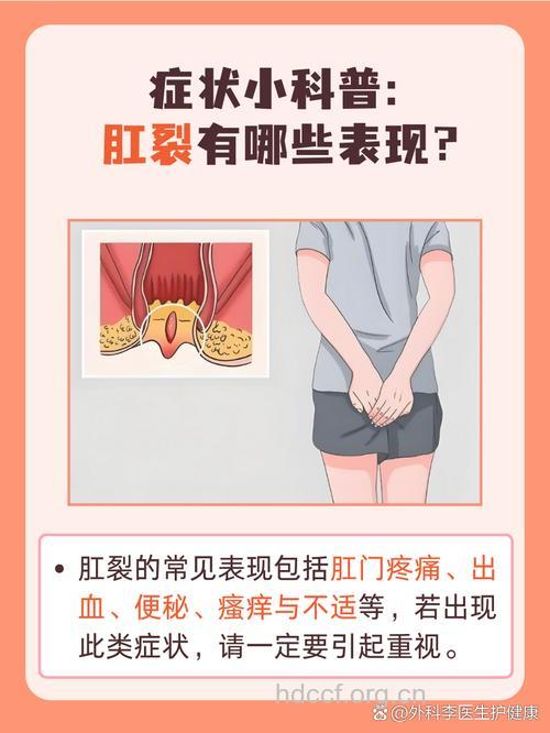 肛裂患者的疼痛有什么特点