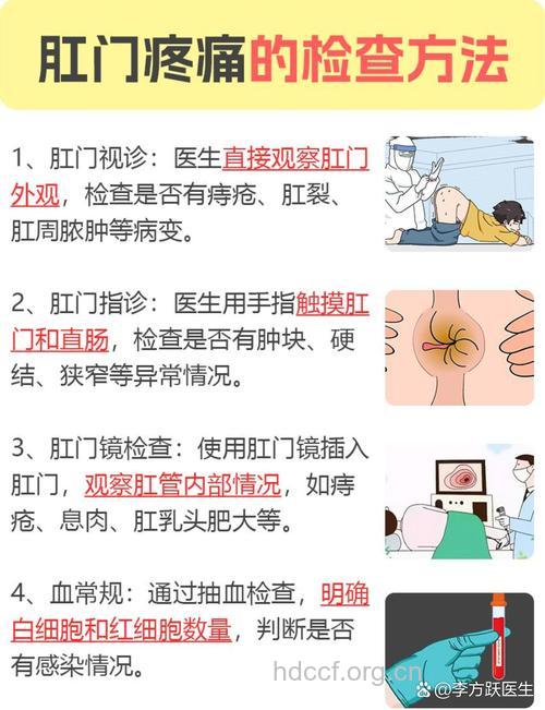 便后肛门疼痛如何处理