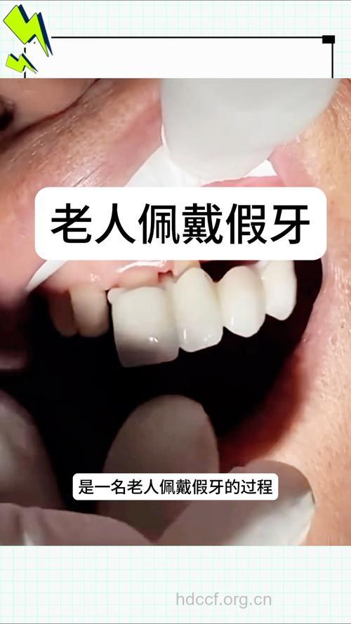 老年人怎么戴假牙方法