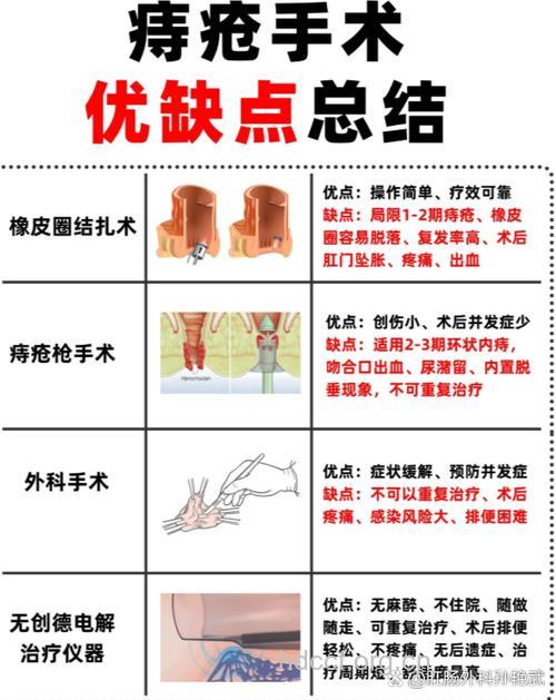 PPH手术有哪些优点