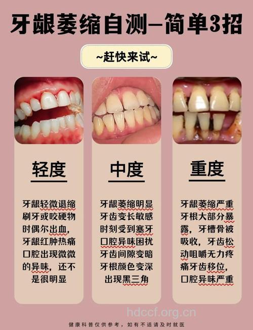 哪些原因导致牙齿过早衰老