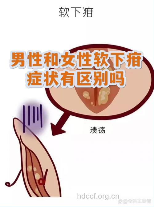 男人得了女人病怎么办