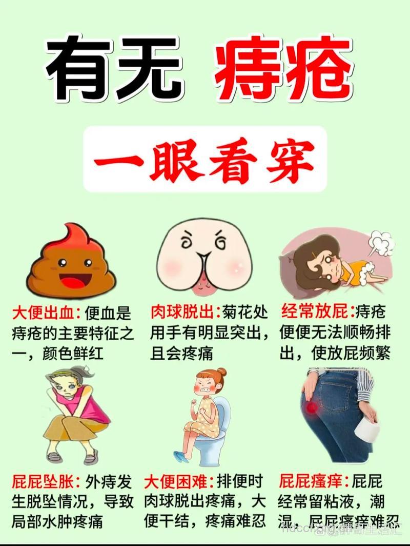 痔疮治愈后会不会复发